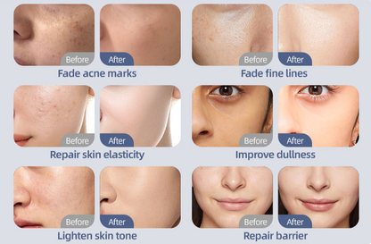 Red Light Therapy LED Face Mask – Skin Rejuvenation & Anti-Aging